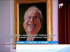 Alexandru Arsinel, transplant cu scandal