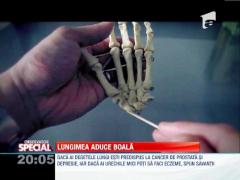 SPECIAL! Lungimea extremitatilor poate indica aparitia unor boli