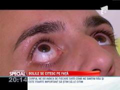 Bolile ni se citesc pe fata