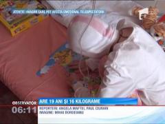 La 19 ani are doar 16 kilograme! Povestea ei l-a înfuriat pe ministrul Sănătăţii