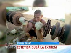 Un brazilian şi-a construit braţele identice cu cele ale lui Popeye marinarul