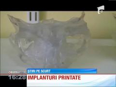 Primul om din lume care are un chip nou datorită tehnologiei 3D