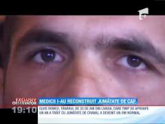 Elvis Romeo, tânărul căruia medicii i-au reconstruit jumătate de cap