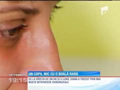 Un copil cu o boală rară