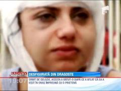 O tânăra din București, desfigurată din dragoste