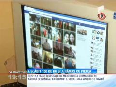 Marius Stoica a slăbit 150 de kilograme, dar acum are exces de piele