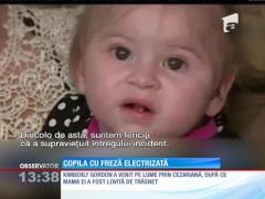 A scăpat cu viață după ce a fost lovită de trăsnet