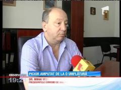 Picior amputat de la o umflătură în talpă