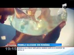 Mihaela, prima femeie din România care și-a pus silicoane