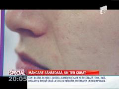 Special! Alimente care distrug tenul