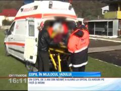 Copil de trei ani internat cu arsuri pe față și pe mâini