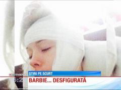 Femeia Barbie a fost bătută crunt!