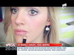 SPECIAL! Scapă de herpes simplu şi rapid