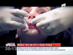 Special! Mărirea buzelor, riscuri și beneficii