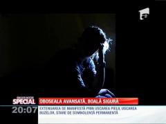 Special! Oboseala avansată, boală sigură