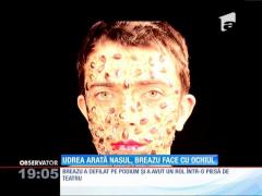 Udrea arata nasul, Breazu face cu ochiul