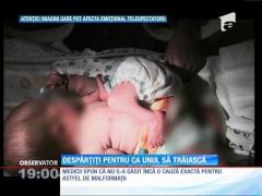 S-au născut lipiţi unul de altul! Iar mama lor îl va strânge doar pe unul în braţe
