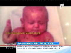 Pacienţii care suferă de mastocitoză se roagă de autorităţi pentru un medicament banal