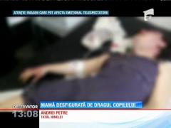 Mamă desfigurată de dragul copilului