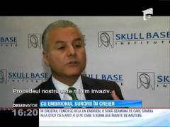 Descoperire macabră! Soră geamănă scoasă din creierul unei femei