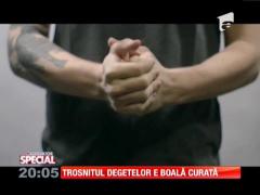 Special! Trosnitul degetelor e boală curată