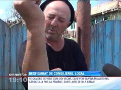 Tânăr desfigurat de consilierul local