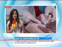 Bucată de deget uman într-un pachet cu carne de pui