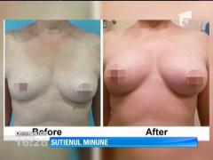 Sutienul care măreşte sânii în doar 7 zile