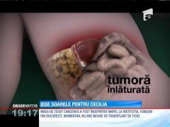 Fetița, operată de o tumoare la ficat, se simte bine
