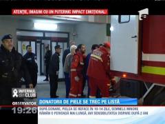 Donatorii de piele se trec pe listă