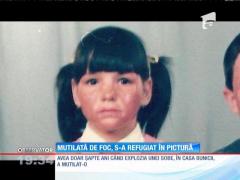 Daniela, o tânără mutilată de foc care s-a refugiat în pictură