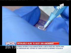 Special! Tatuajele albe, la modă