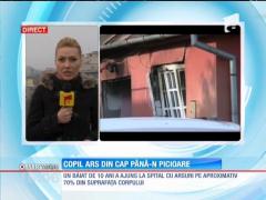 Un copil din Botoşani a ajuns la spital cu arsuri pe 70% din suprafaţa corpului