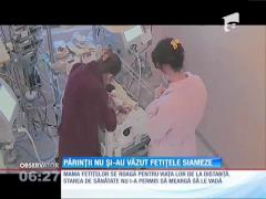 Părinţii siamezelor născute la Constanţa nu le-au văzut pe fetiţe decât în poze