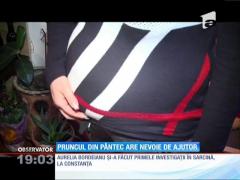 Drama unei gravide. Pruncul din pântec are nevoie de ajutor