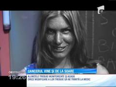 Expunerea neprotejată la soare poate duce la cancer de piele