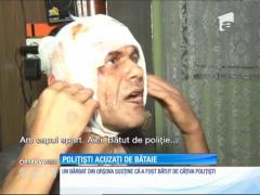 Un bărbat din Orşova susţine că a fost bătut de câţiva poliţişti