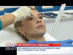 Special! Cum tratăm petele pigmentate