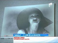 La aproape un an de la tragedia Colectiv, o supravieţuitoare nu se fereşte să-şi arate rănile, mâinile schilodite, capul ars şi braţele sfredelite în fotografii emoţionante (FOTO + VIDEO)