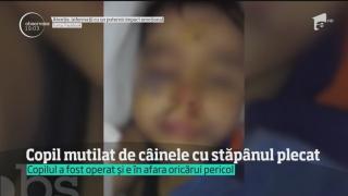 IMAGINI ŞOCANTE! Un băieţel de 5 ani a fost SFÂŞIAT de un câine maidanez, în timp ce se juca pe stradă, la Techirghiol