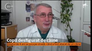 Familia copilului muşcat de un câine la Techirghiol ar putea fi acuzată de neglijenţă