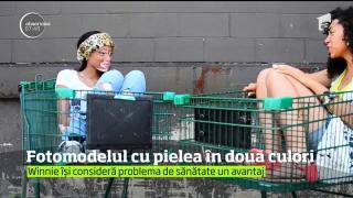 Apariţie inedită pe podium: Winnie Harlow, modelul în două culori (VIDEO)