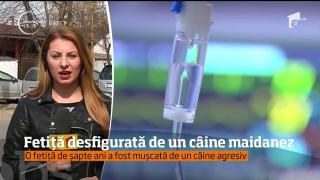 Oroare în Târgu Jiu: O fetiţă de şapte ani a fost DESFIGURATĂ  de un câine maidanez chiar în centrul oraşului