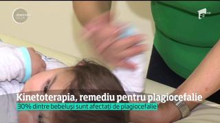 Kinetoterapia, remediu pentru plagiocefalie