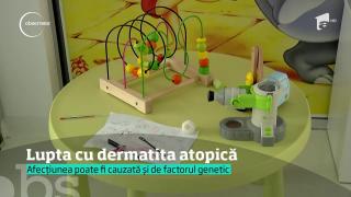 Cum se tratează DERMATITA ATOPICĂ