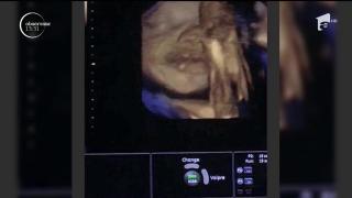 Mădălina Ghenea şi iubitul ei, Matei Stratan, sunt proaspeţi PĂRINŢI! (VIDEO)