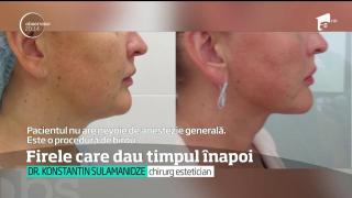 Firele "minune" care dau timpul înapoi! Noua procedură promite să le întinerească pe românce