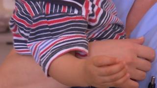 Rujeola e scăpată de sub control, în România! Un bebelus de 5 luni a murit la Iaşi! A 28-a victimă din ţară