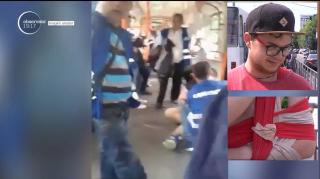 Un tânăr bucureştean s-a ales cu umărul dizlocat de controlorii RATB, doar pentru că nu avea bilet