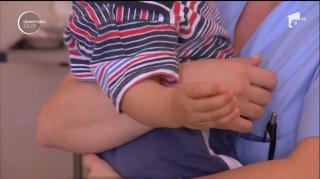 Concluzie-şoc! 10 din cei 30 de copii şi tineri ucişi de rujeolă în România au luat boala DIN SPITALE